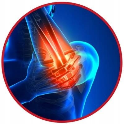 Orteza stawu łokciowego Mueller 4521 rozmiar uniwersalny